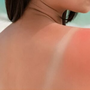 Home tanning